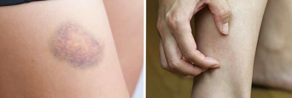 10 Signs Your Body Sends You When Something May Be Wrong