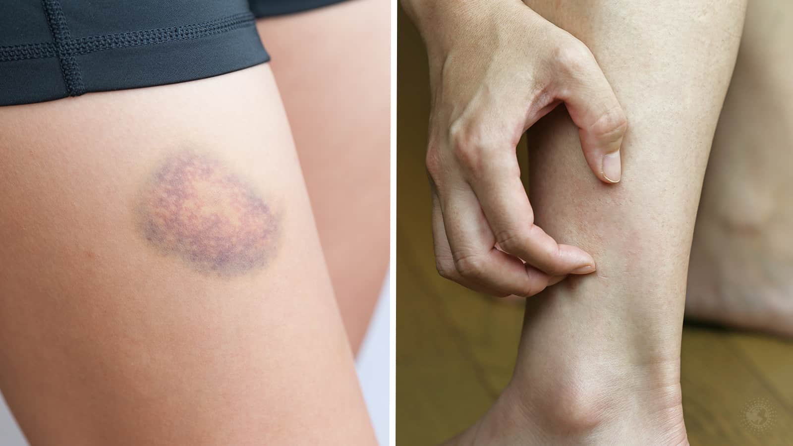 10 Signs Your Body Sends You When Something May Be Wrong