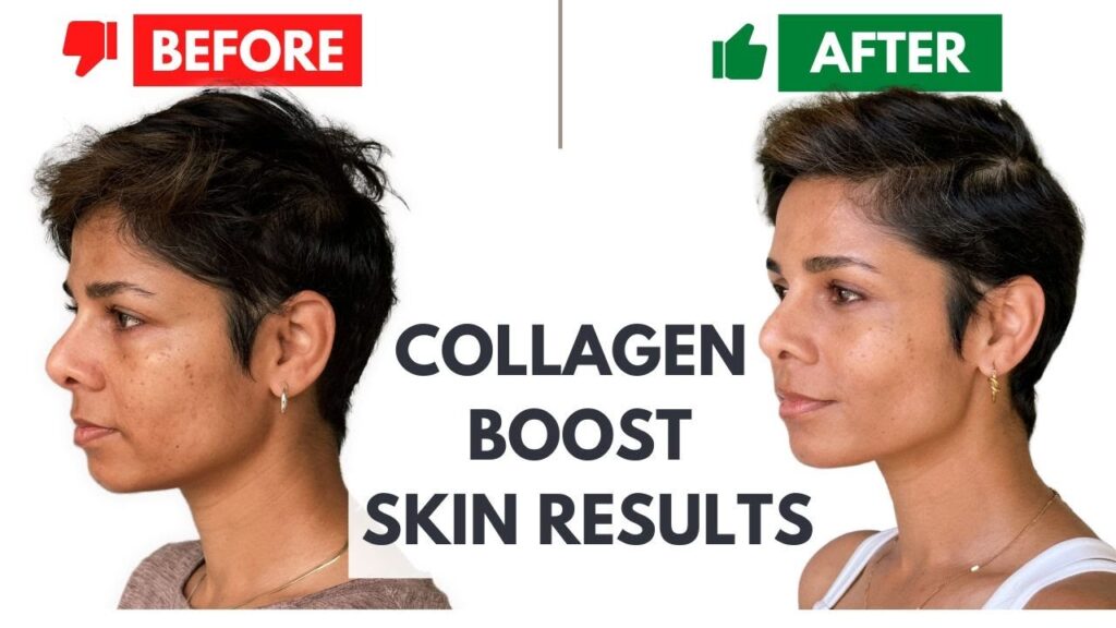 5 Ways to Boost Your Collagen Levels
