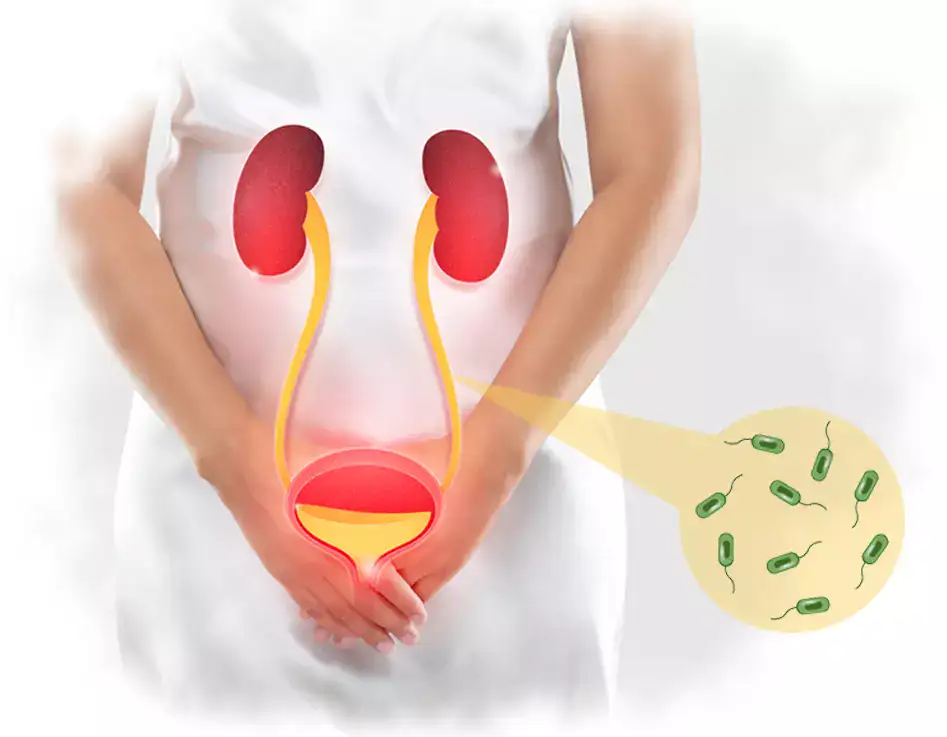 Natural Remedies For Cystitis and Vaginal Infections
